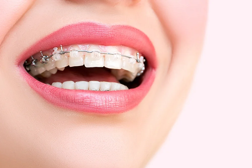 DENTIST Flaunt your pearly whites with the best dentist in Borivali